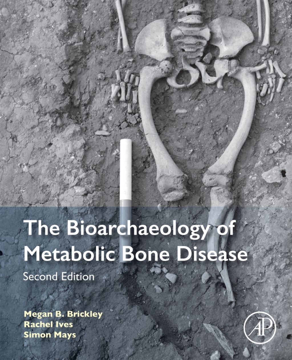 The Bioarchaeology of Metabolic Bone Disease 2nd Edition