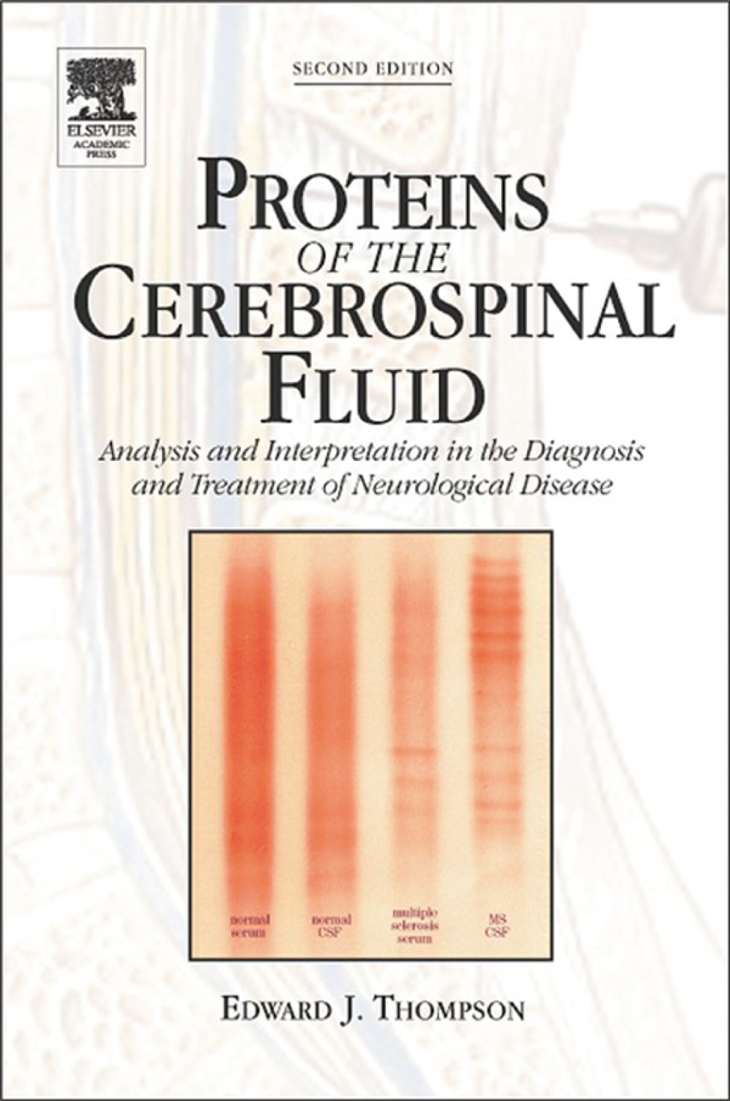 Proteins of the Cerebrospinal Fluid: Analysis & Interpretation in the Diagnosis and Treatment of Neurological Disease