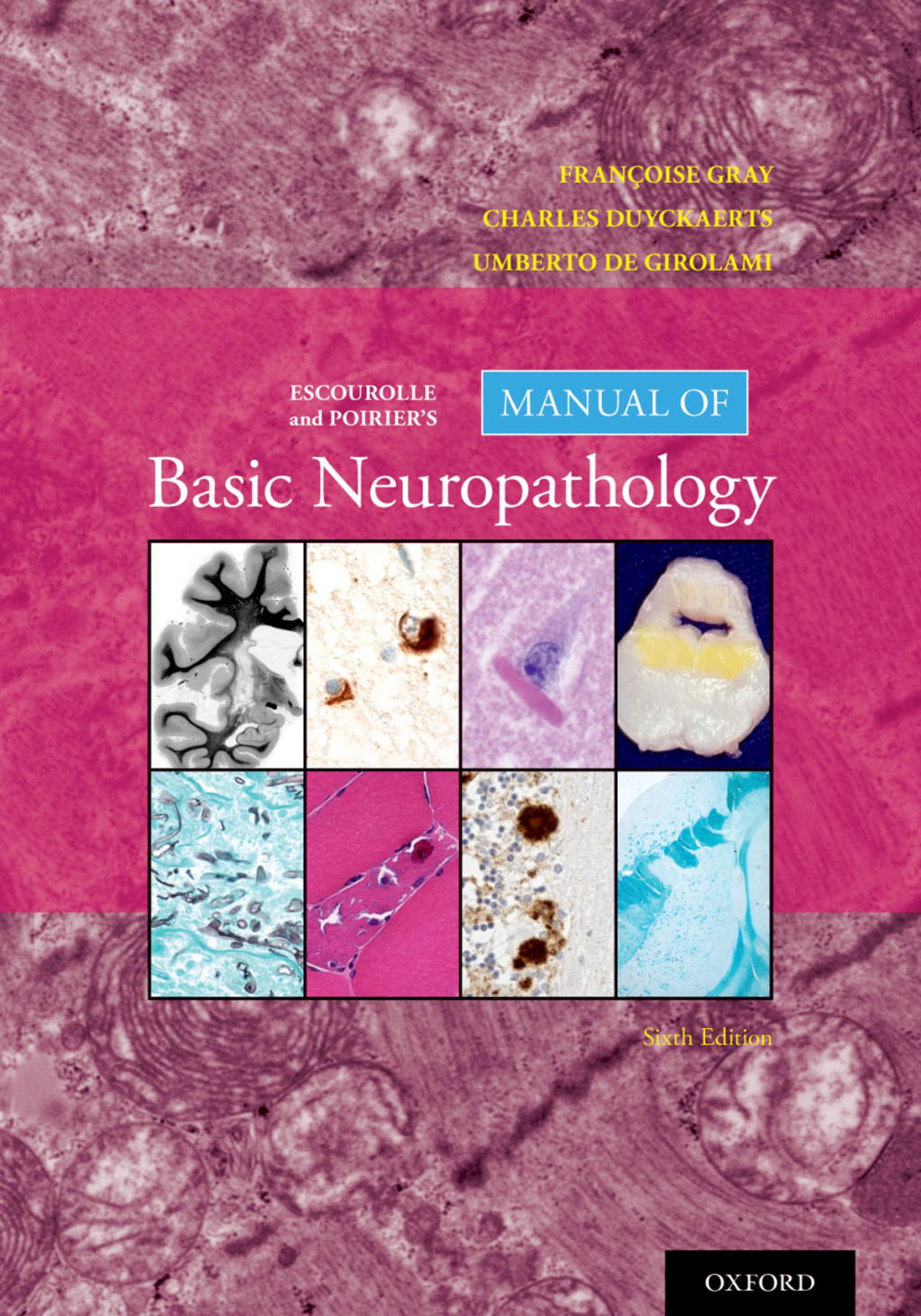 Escourolle and Poirier's Manual of Basic Neuropathology 6th Edition
