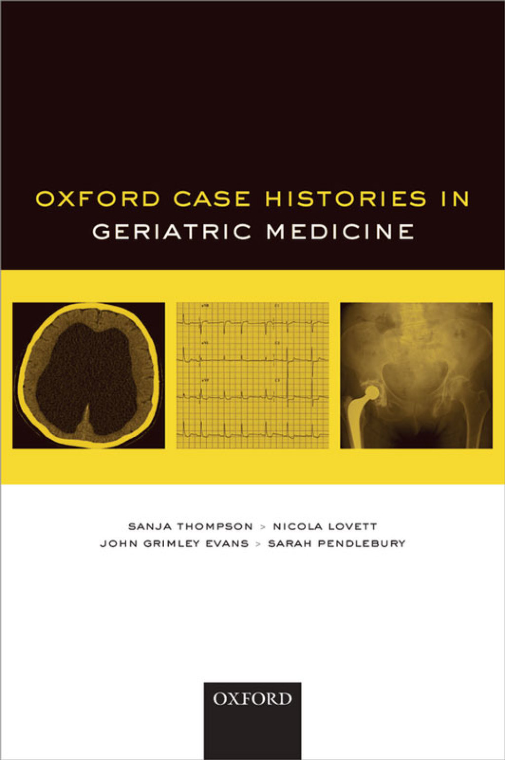 Oxford Case Histories in Geriatric Medicine 1st Edition