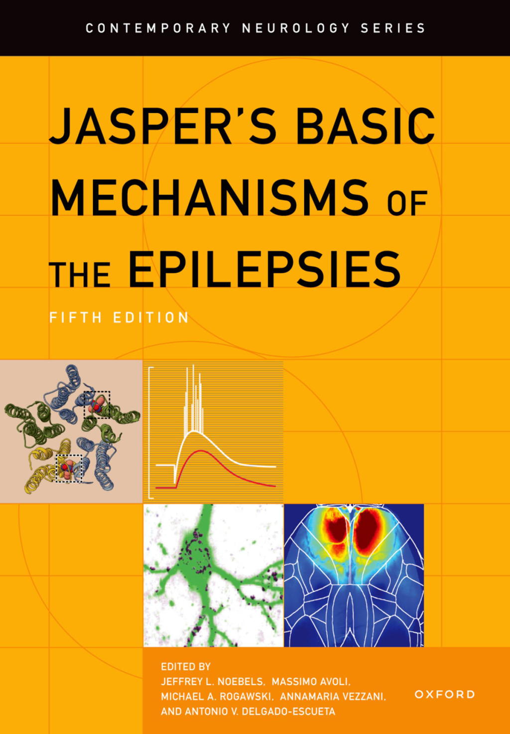 Jasper's Basic Mechanisms of the Epilepsies 5th Edition