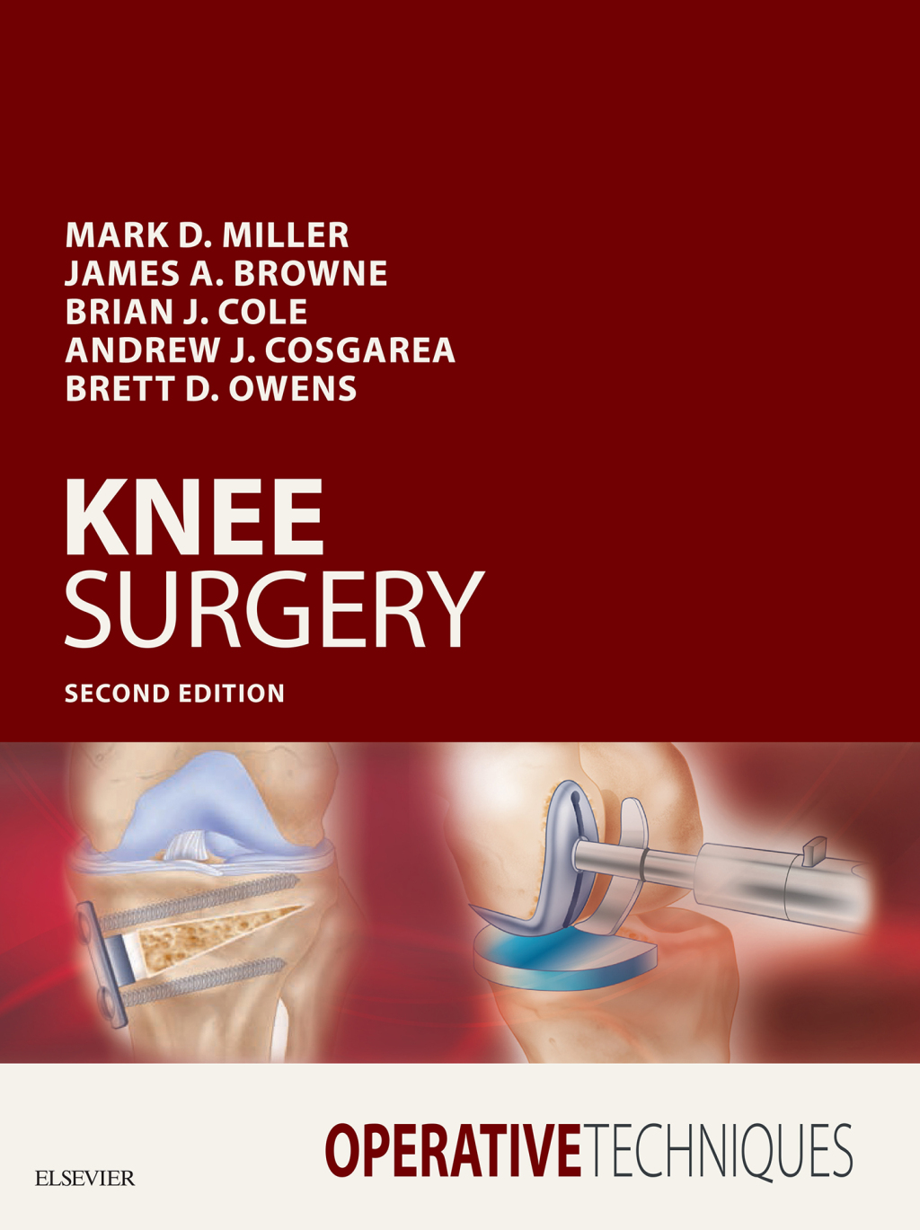 Operative Techniques: Knee Surgery 2nd Edition