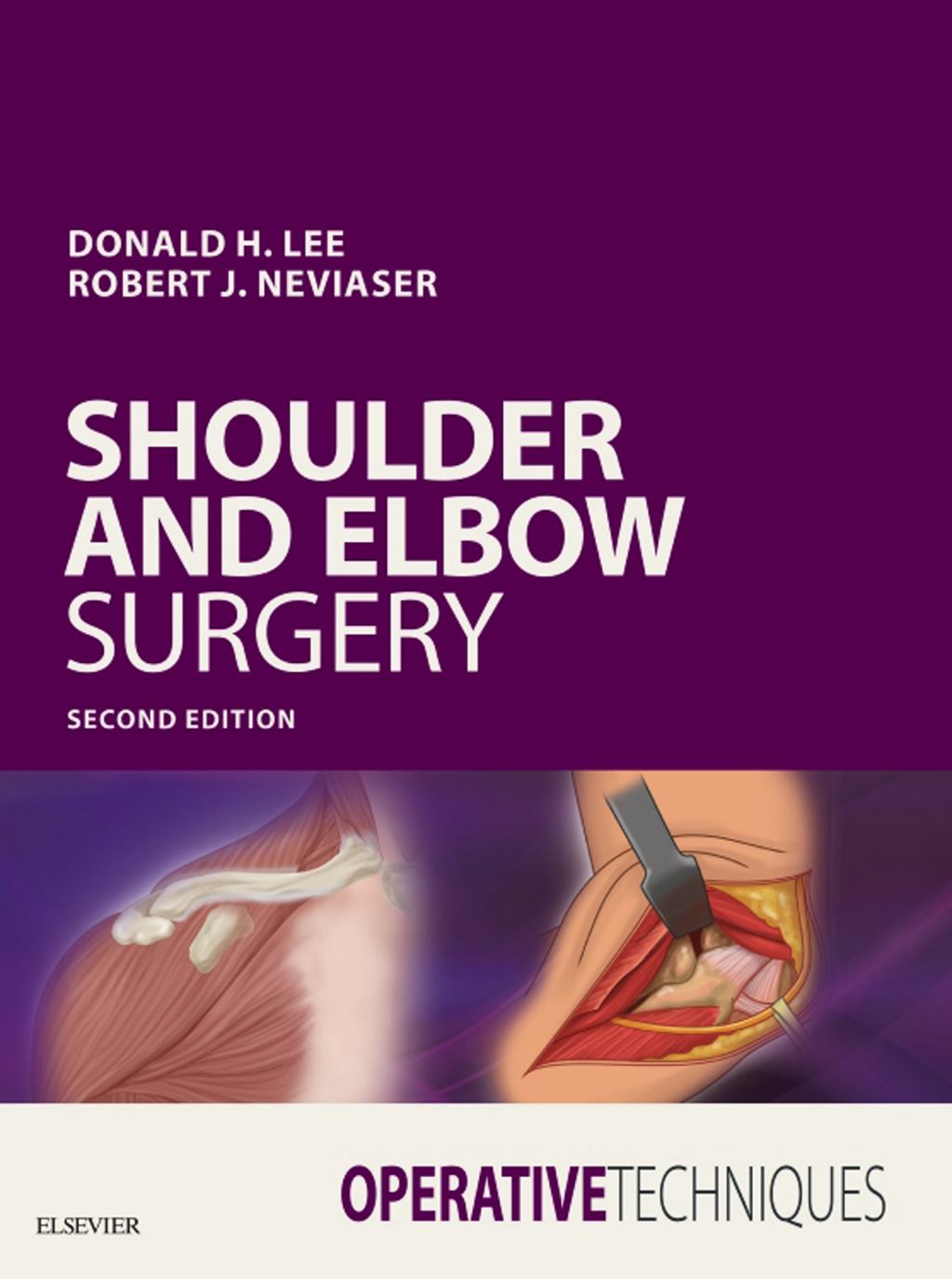 Operative Techniques: Shoulder and Elbow Surgery 2nd Edition