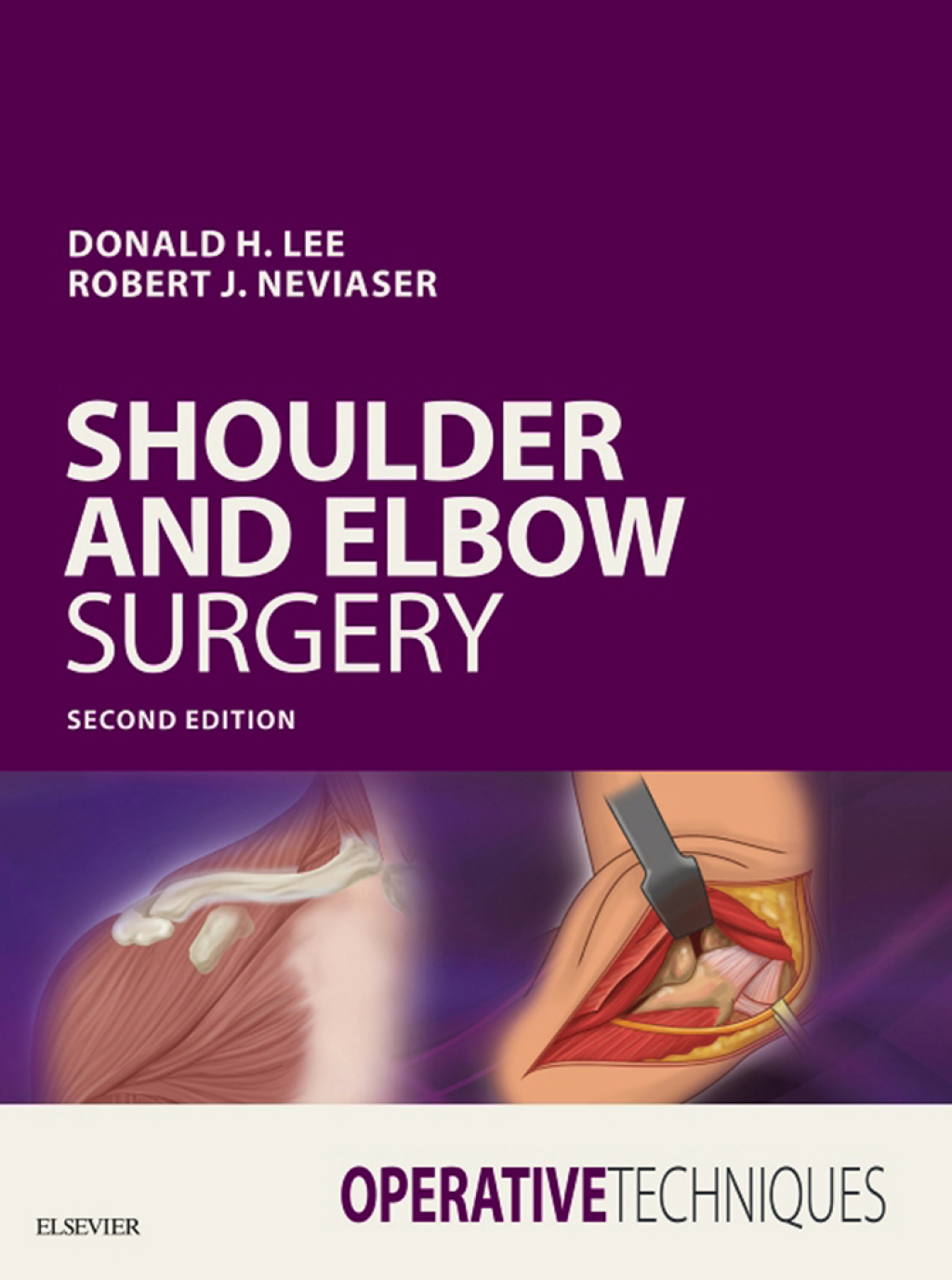 Operative Techniques: Shoulder and Elbow Surgery 2nd Edition