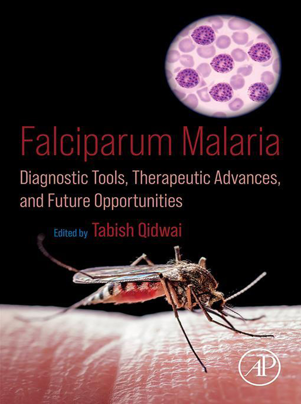 Falciparum Malaria Diagnostic Tools, Therapeutic Advances, and Future Opportunities 1st Edition