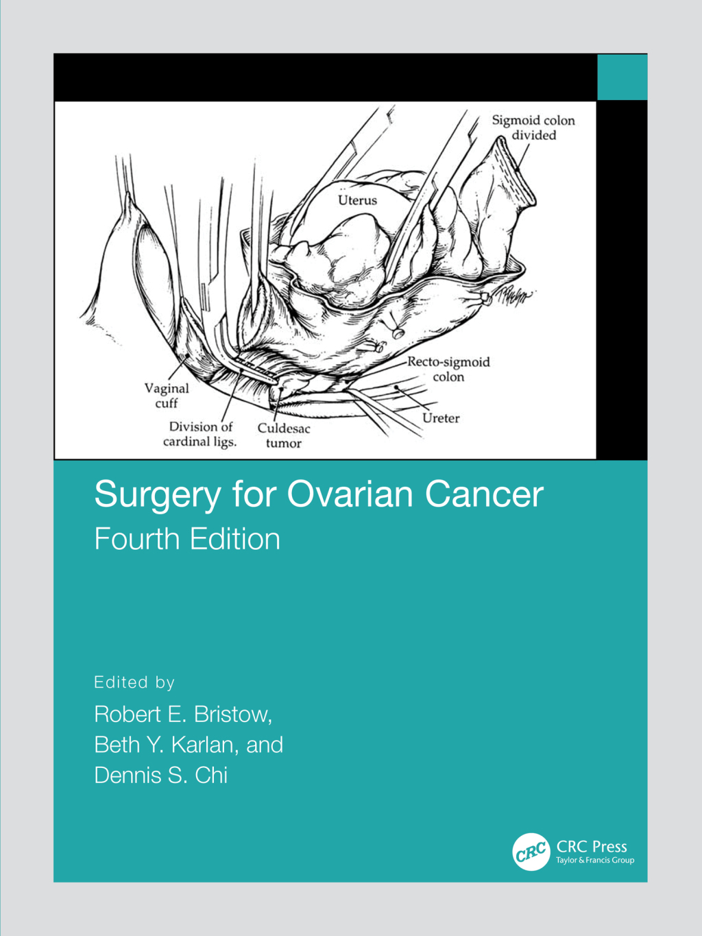 Surgery for Ovarian Cancer 4th Edition
