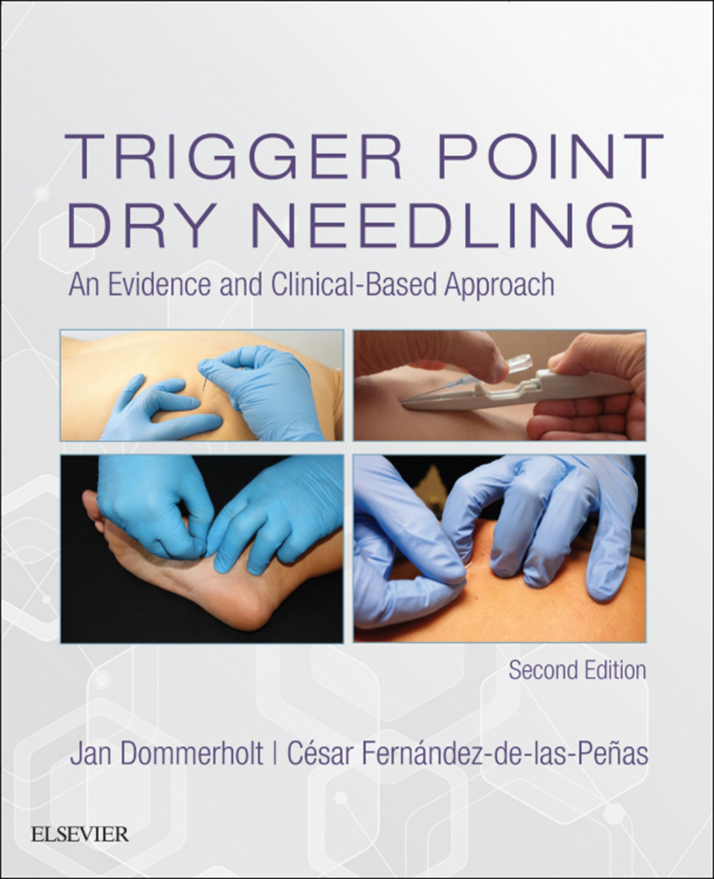 Trigger Point Dry Needling An Evidence and Clinical-Based Approach 2nd Edition