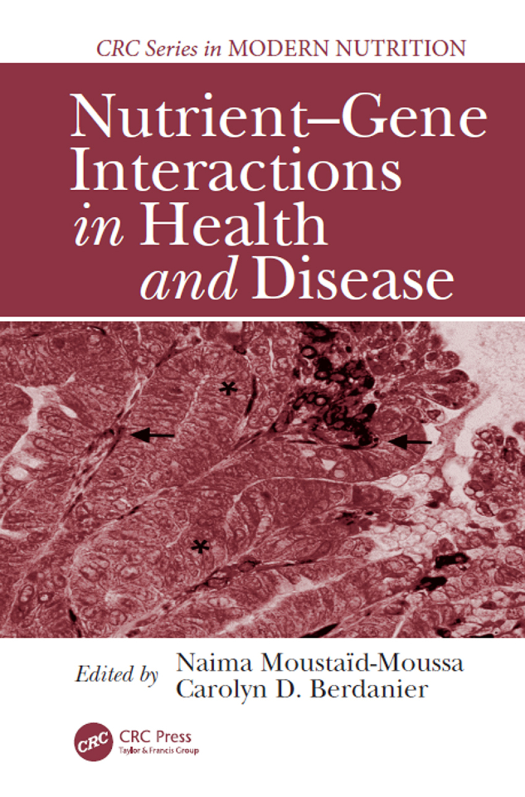 Nutrient-Gene Interactions in Health and Disease 2nd Edition