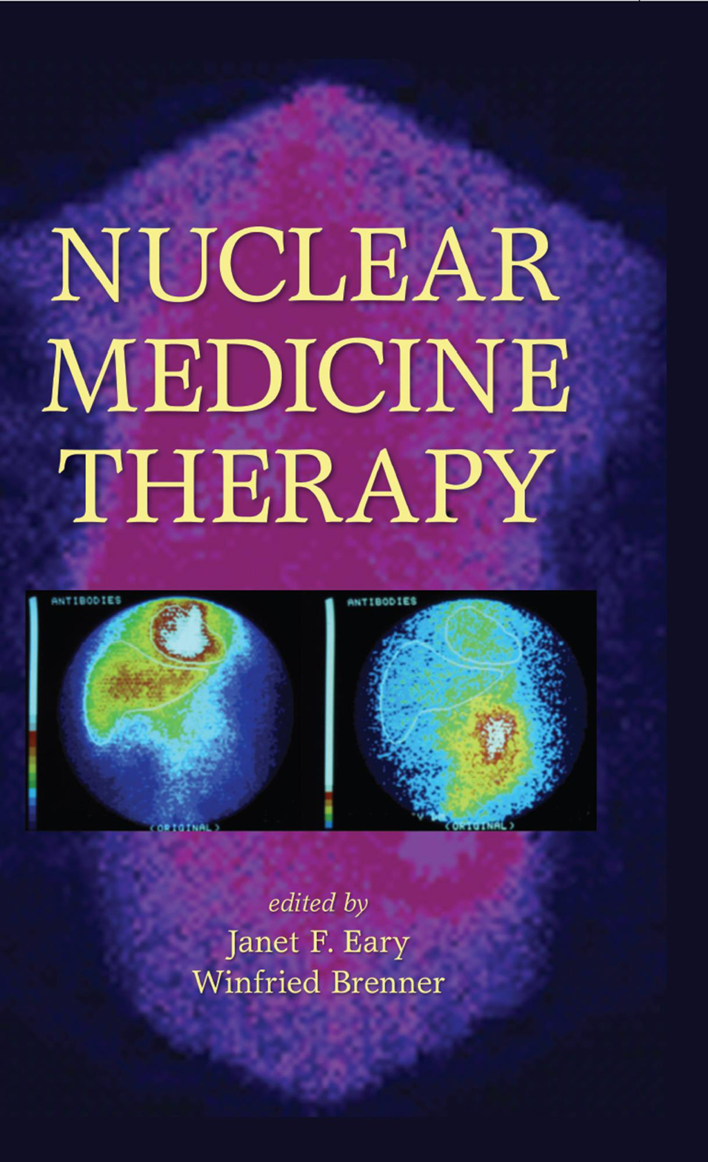 Nuclear Medicine Therapy 1st Edition