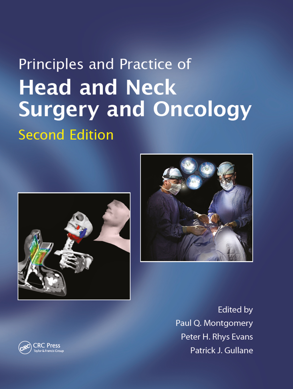 Principles and Practice of Head and Neck Surgery and Oncology 2nd Edition