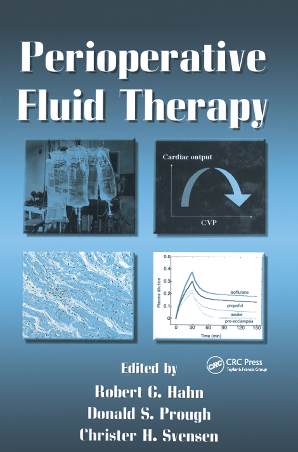 Perioperative Fluid Therapy 1st Edition