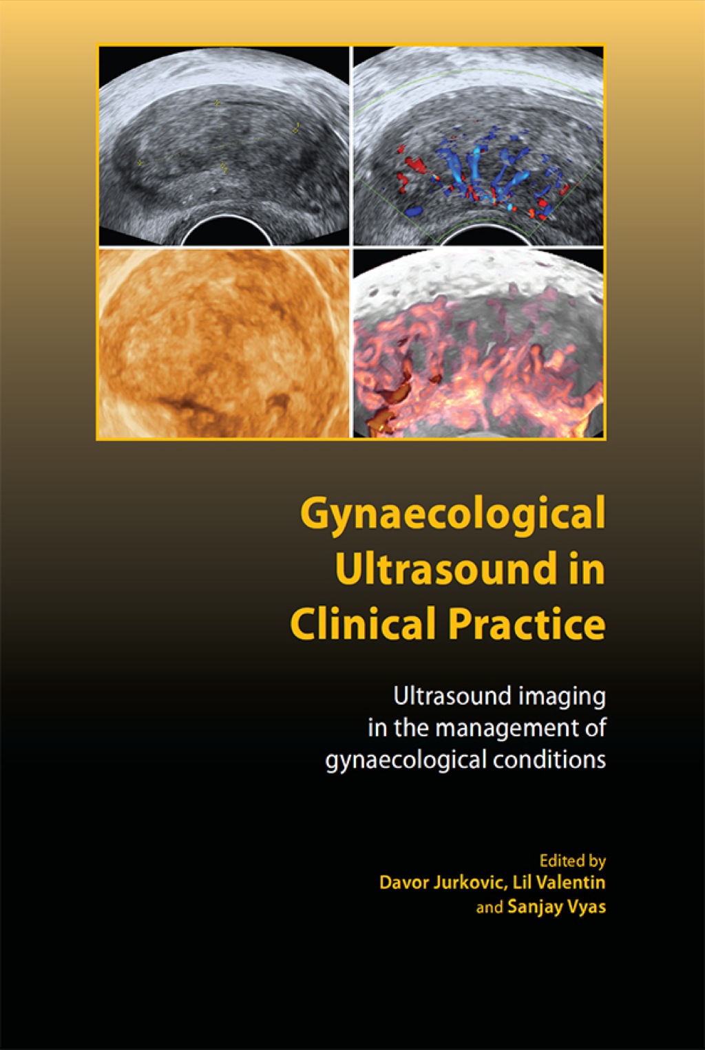Gynaecological Ultrasound in Clinical Practice 1st Edition