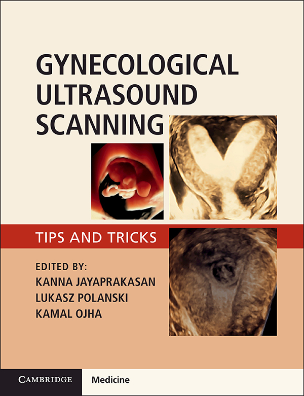 Gynaecological Ultrasound Scanning Tips and Tricks