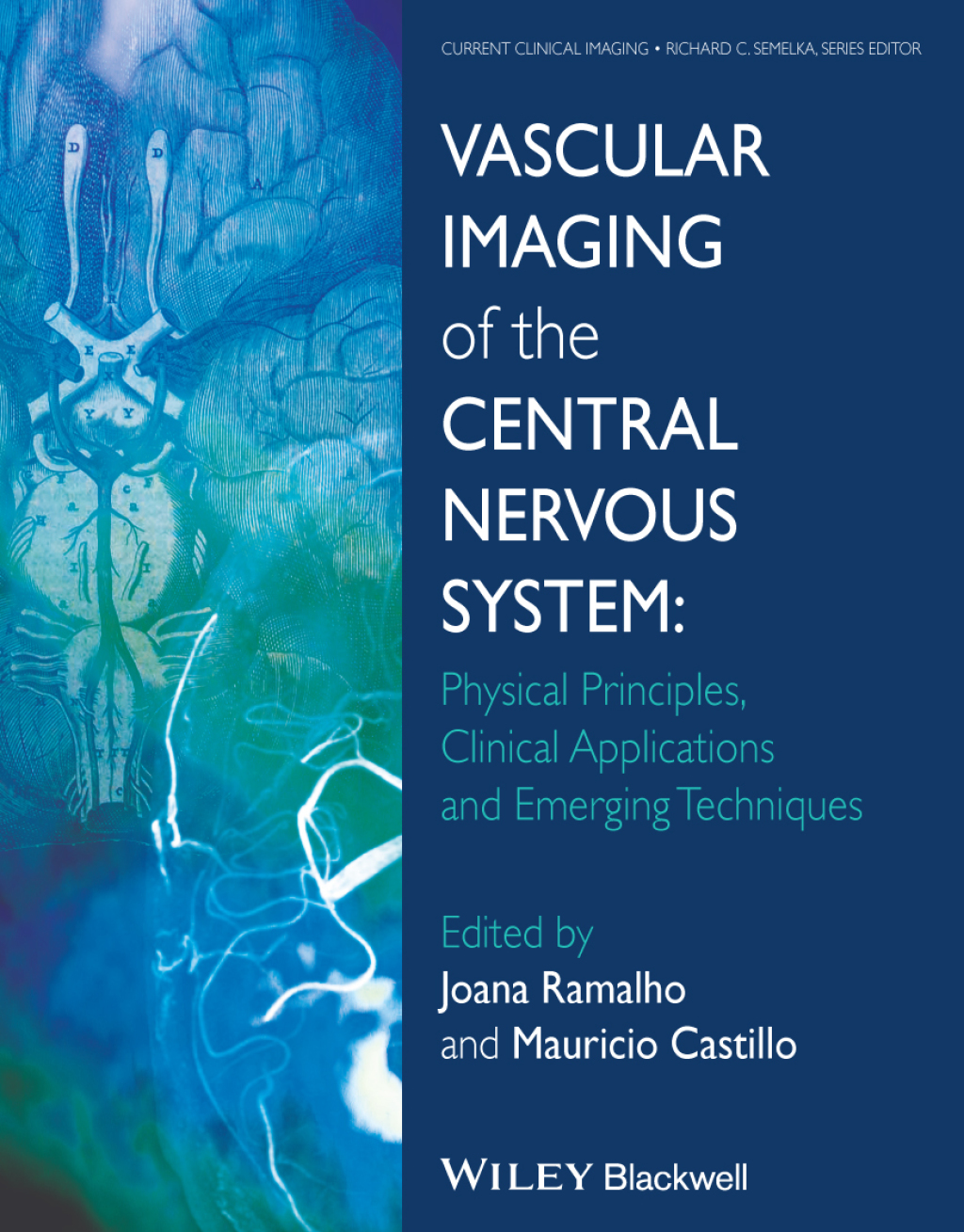Vascular Imaging of the Central Nervous System Physical Principles, Clinical Applications, and Emerging Techniques 1st Edition