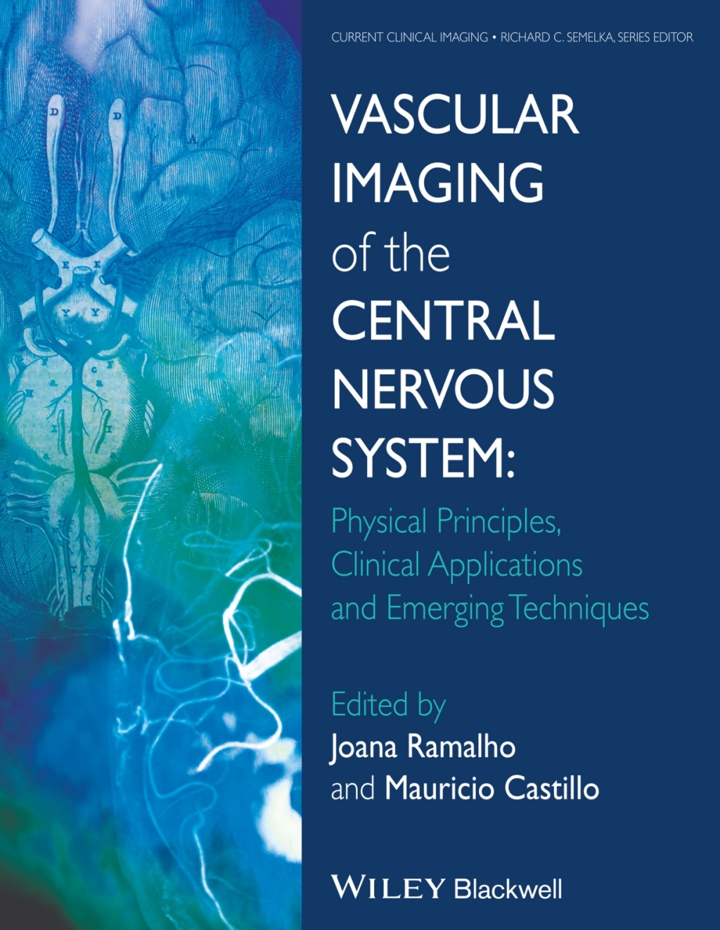 Vascular Imaging of the Central Nervous System Physical Principles, Clinical Applications, and Emerging Techniques 1st Edition