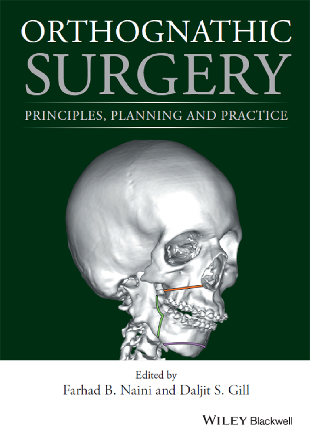 Orthognathic Surgery: Principles, Planning and Practice Principles, Planning and Practice 1st Edition