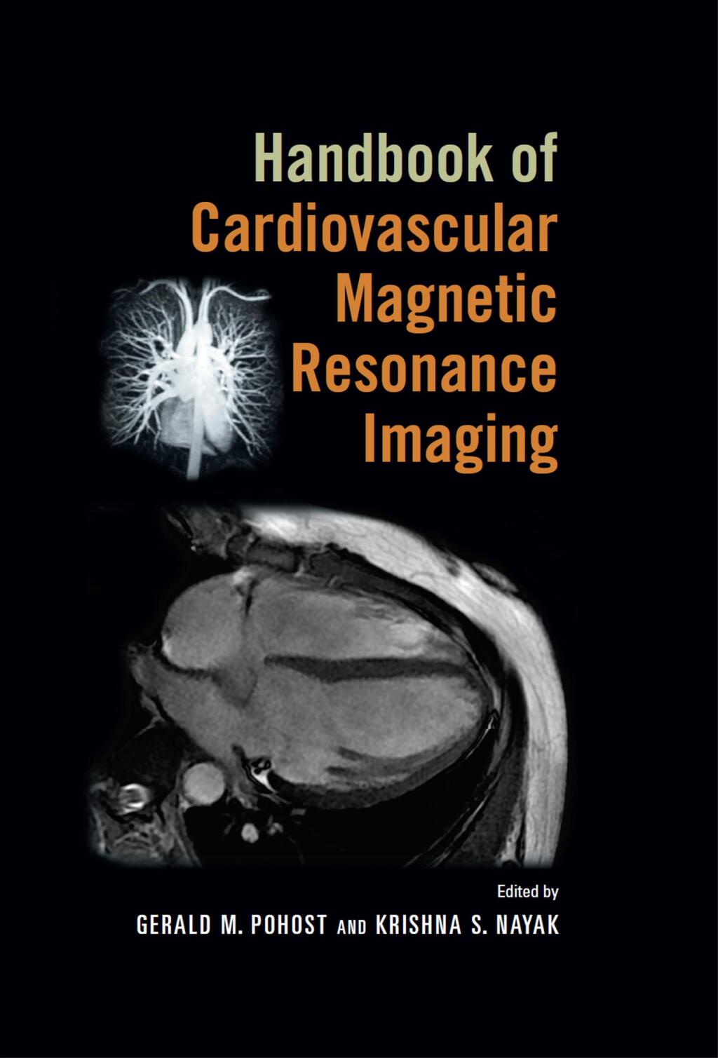 Women and Heart Disease 2nd Edition