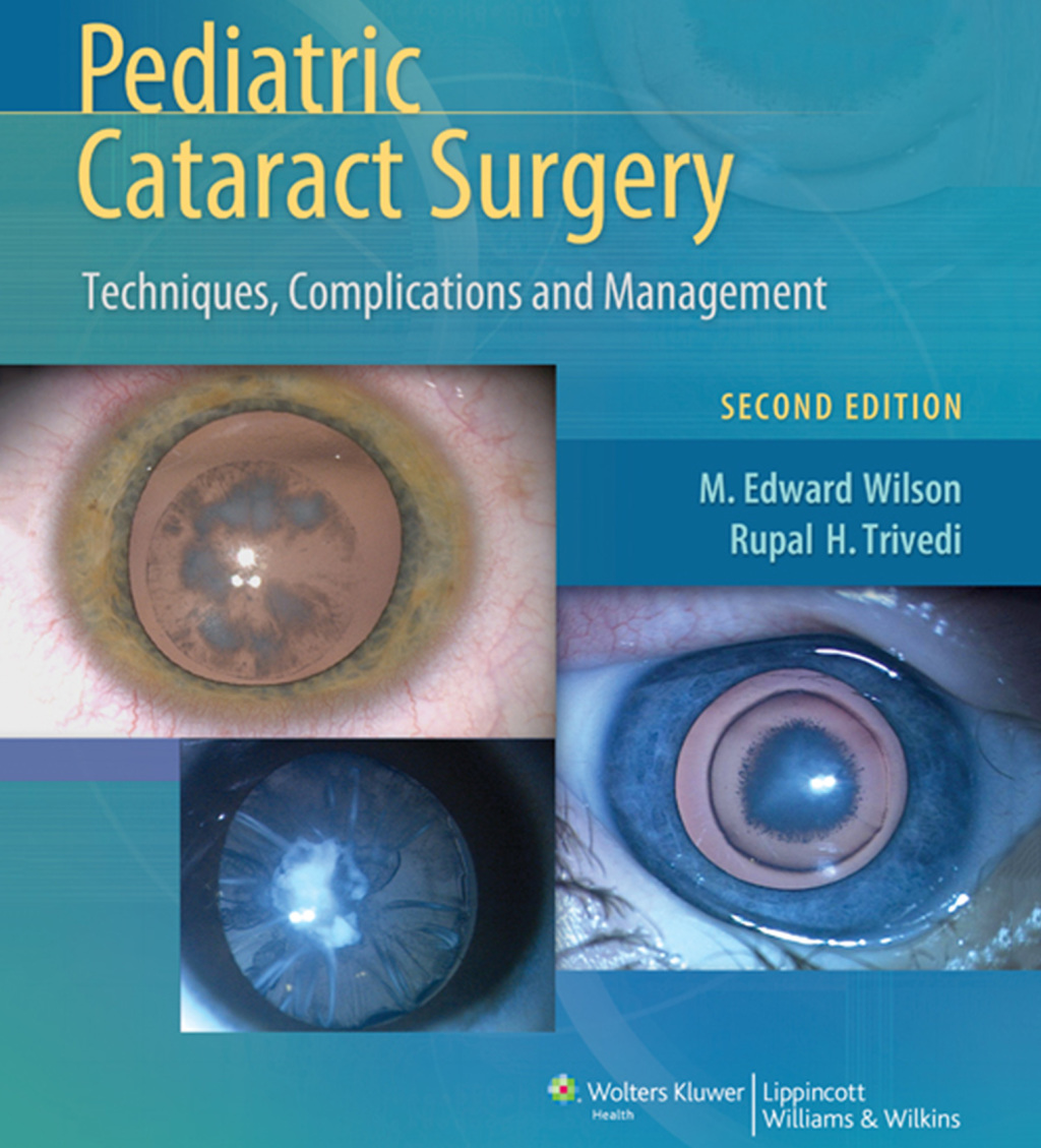Pediatric Cataract Surgery Techniques, Complications and Management 2nd Edition