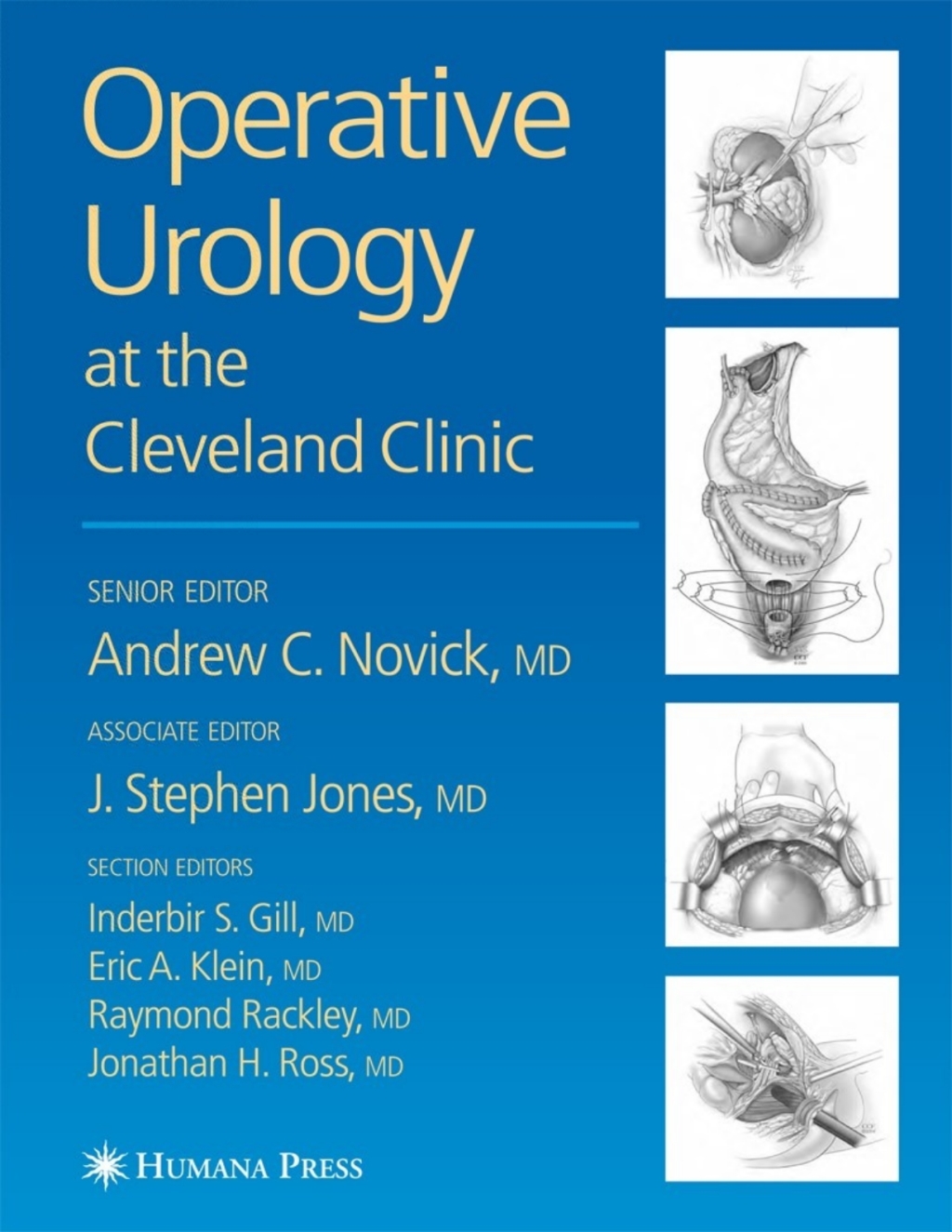 Operative Urology 1st Edition
