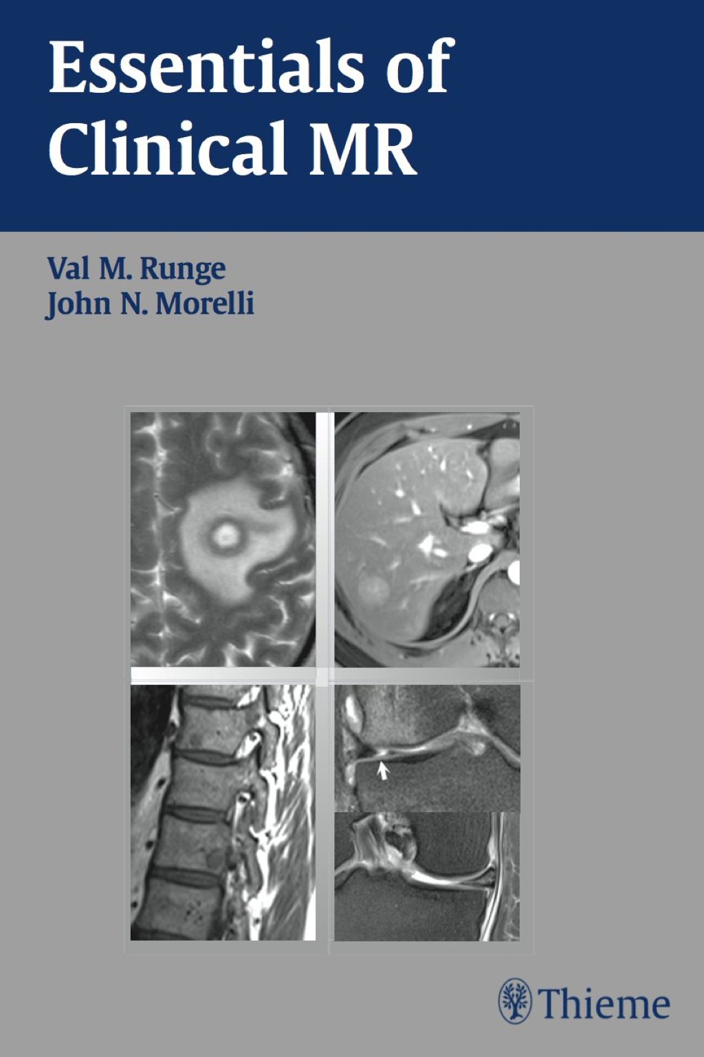 Essentials of Clinical MR 1st Edition
Newer Edition Available
