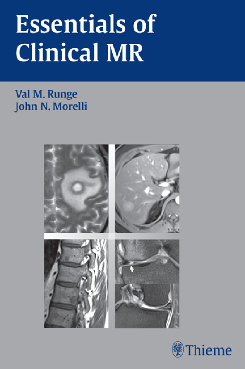 Essentials of Clinical MR 1st Edition