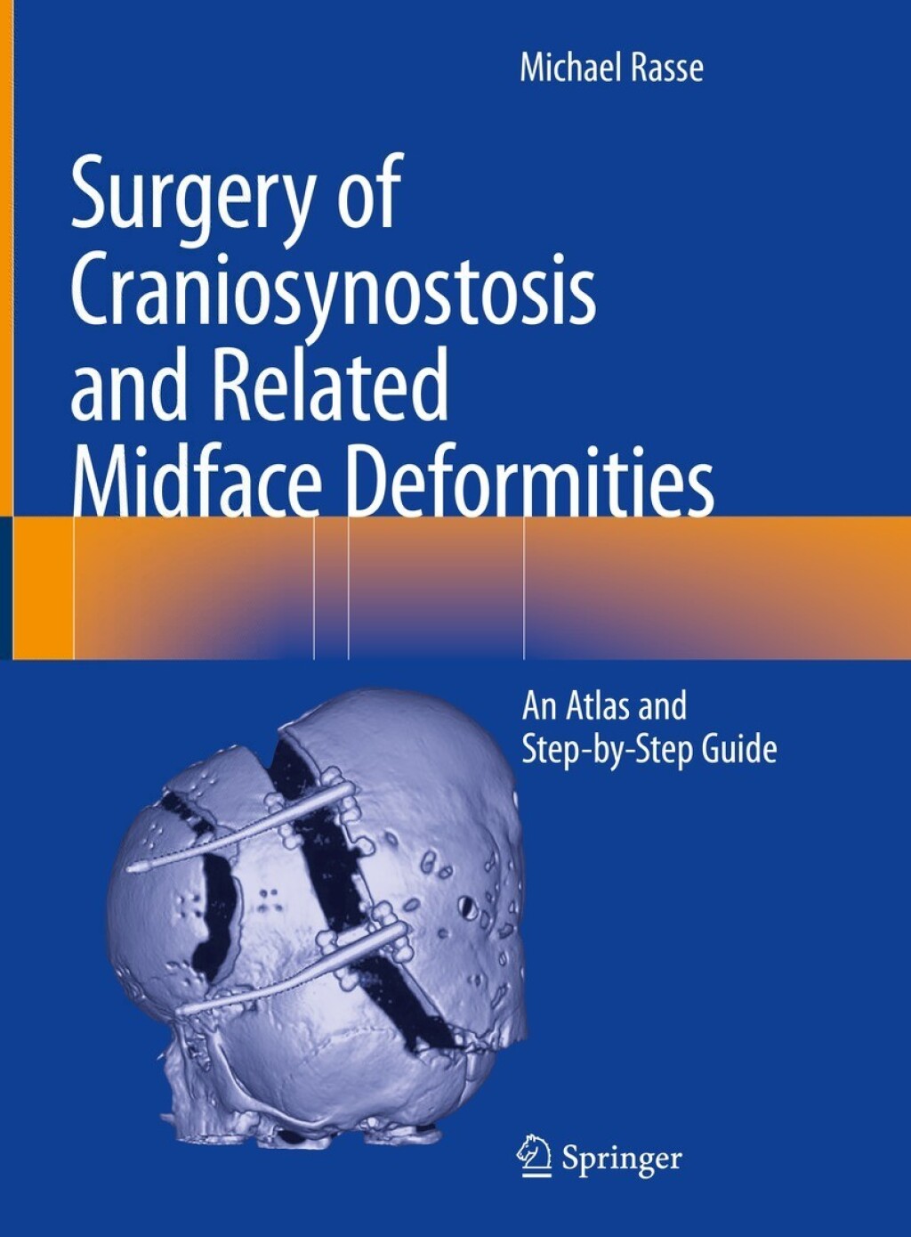 Surgery of Craniosynostosis and Related Midface Deformities An Atlas and Step-by-Step Guide