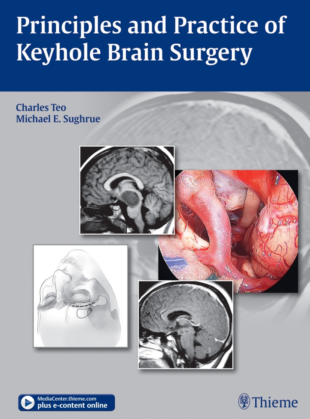 Principles and Practice of Keyhole Brain Surgery 1st Edition
Newer Edition Available
