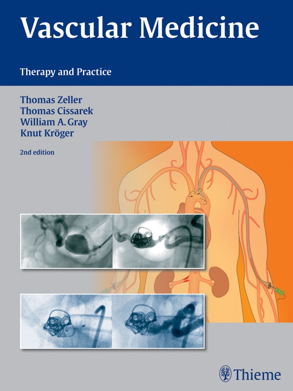 Vascular Medicine Therapy and Practice 2nd Edition
    Newer Edition Available
