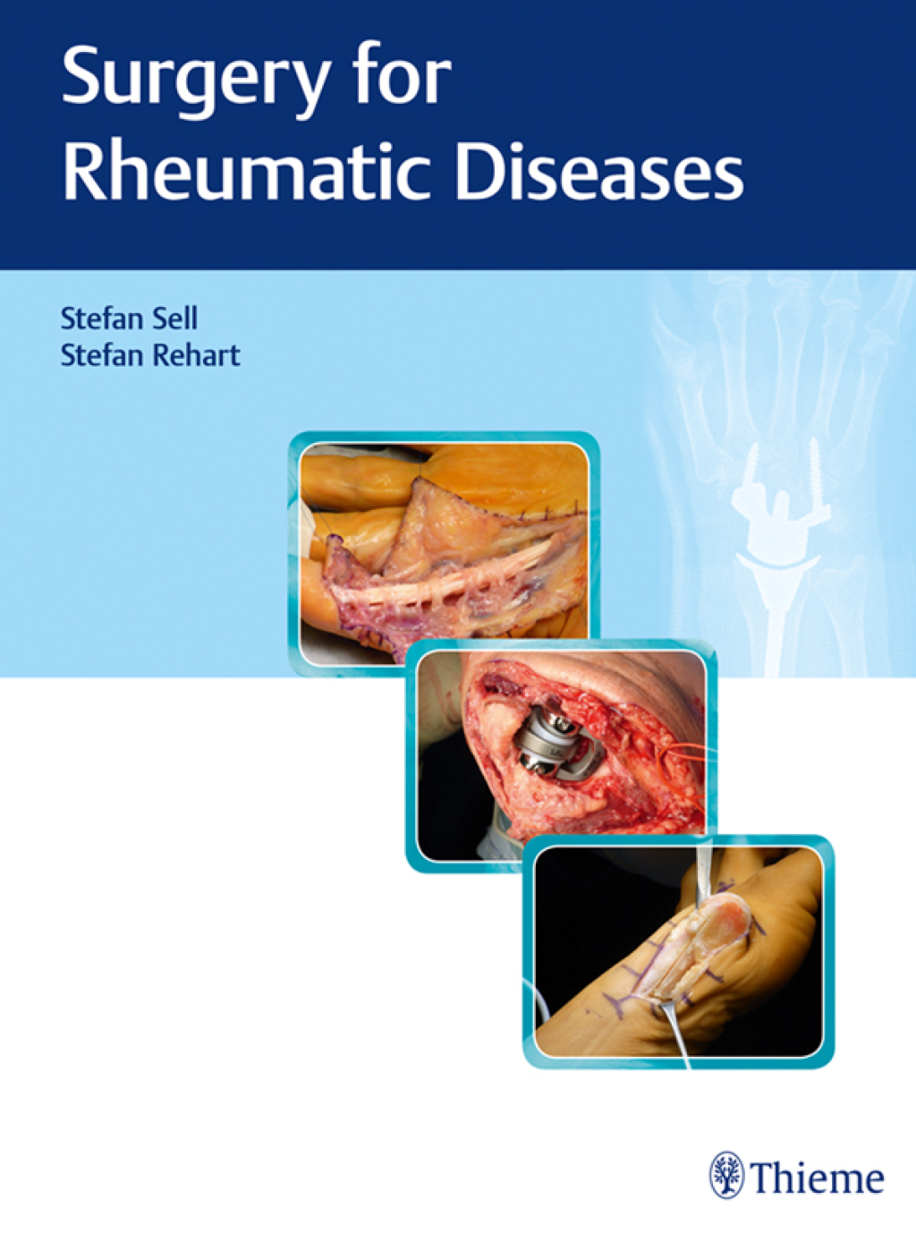 Surgery for Rheumatic Diseases 1st Edition