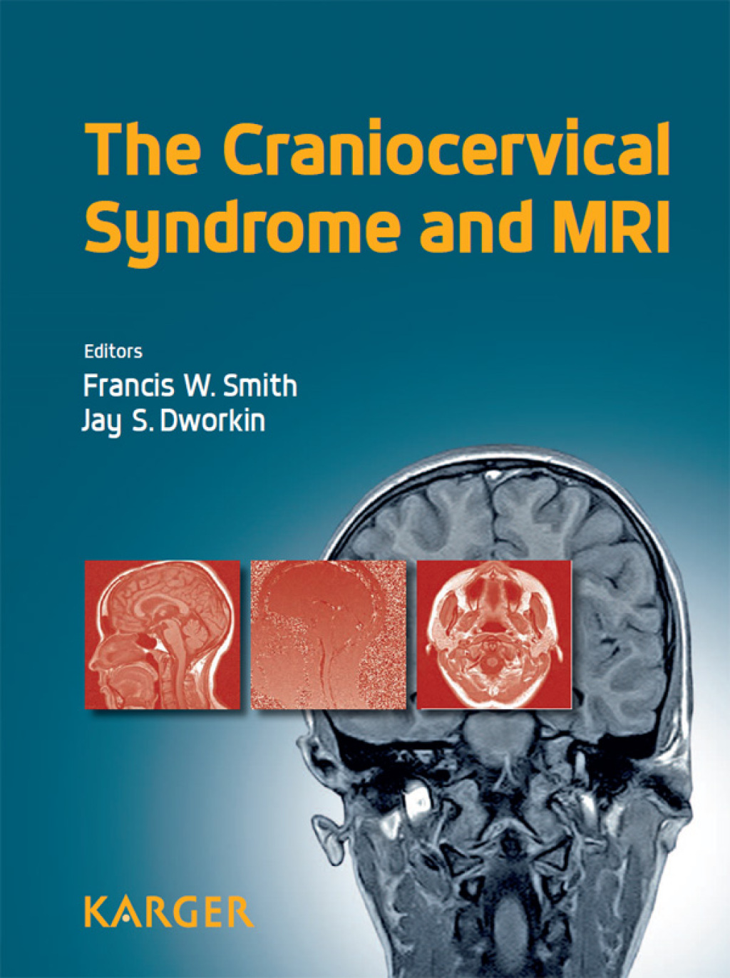The Craniocervical Syndrome and MRI 1st Edition