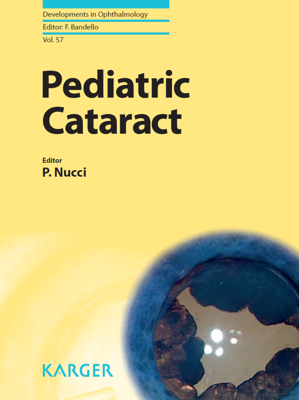 Pediatric Cataract 1st Edition