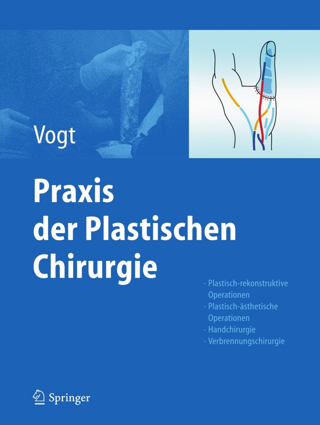 Praxis der Plastischen Chirurgie Plastisch-rekonstruktive Operationen - Plastisch-ästhetische Operationen - Handchirurgie - Verbrennungschirurgie 1st Edition