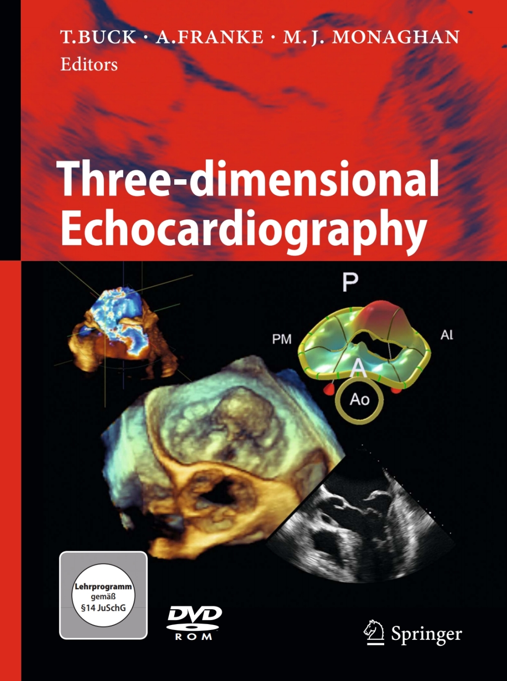 Three-dimensional Echocardiography 1st Edition