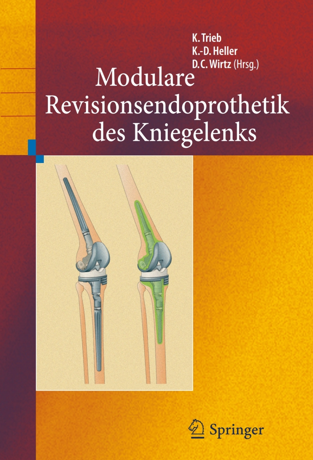 Revisionsendoprothetik des Kniegelenks 1st Edition