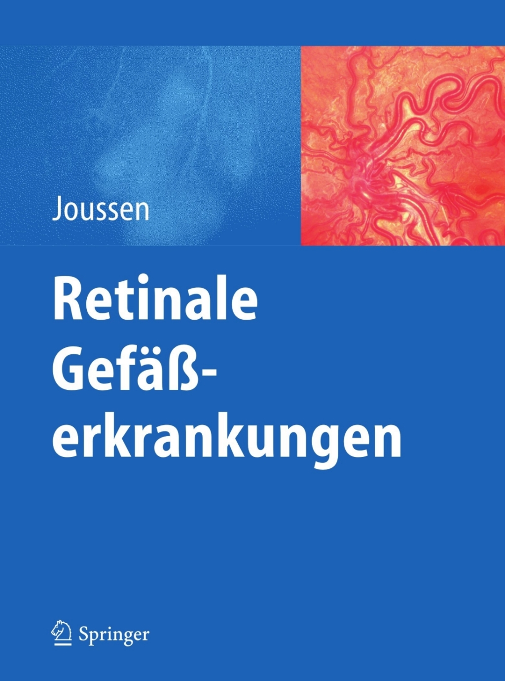 Retinale Gefäßerkrankungen 1st Edition