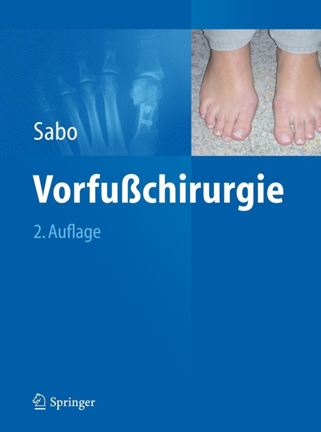 Vorfußchirurgie 2nd Edition