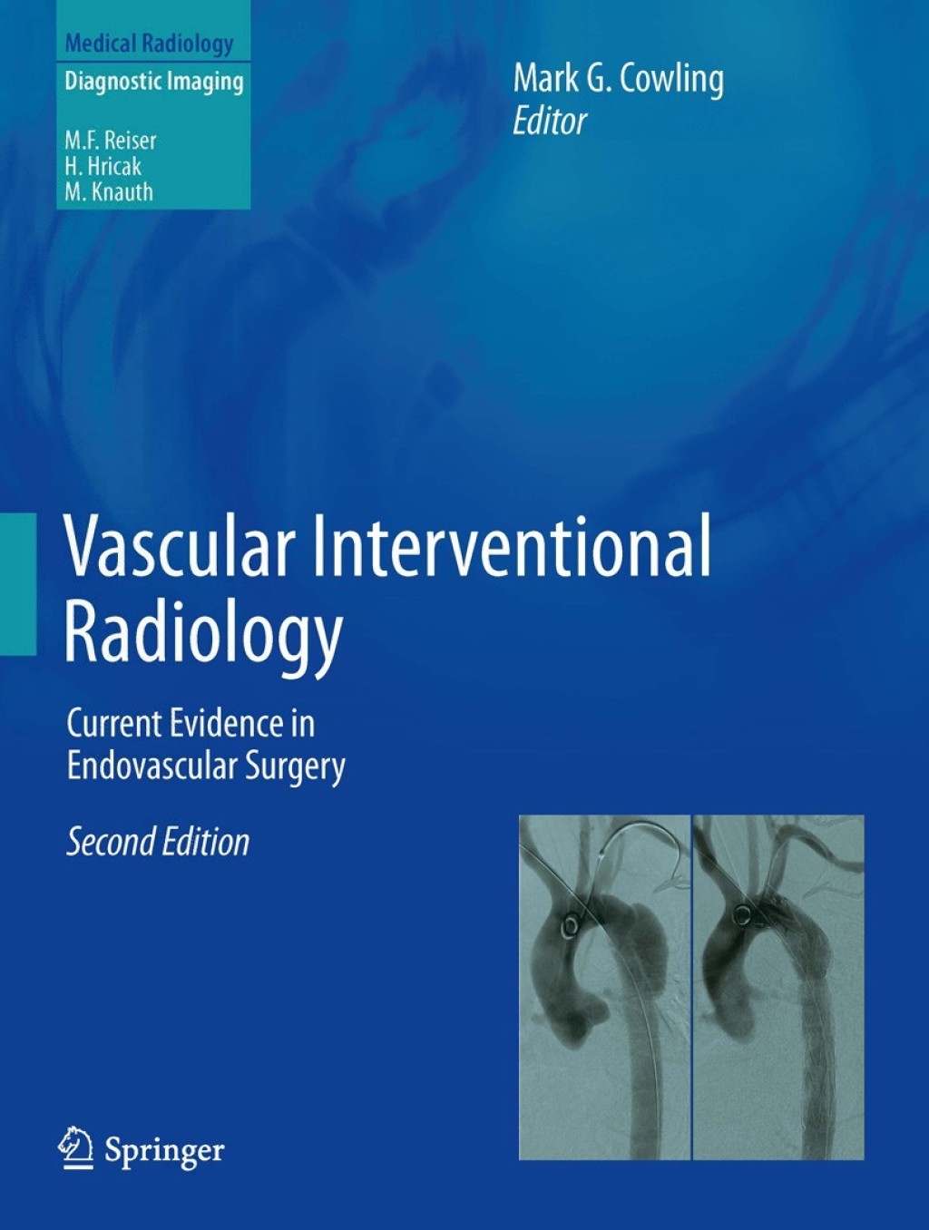 Vascular Interventional Radiology Current Evidence in Endovascular Surgery 2nd Edition