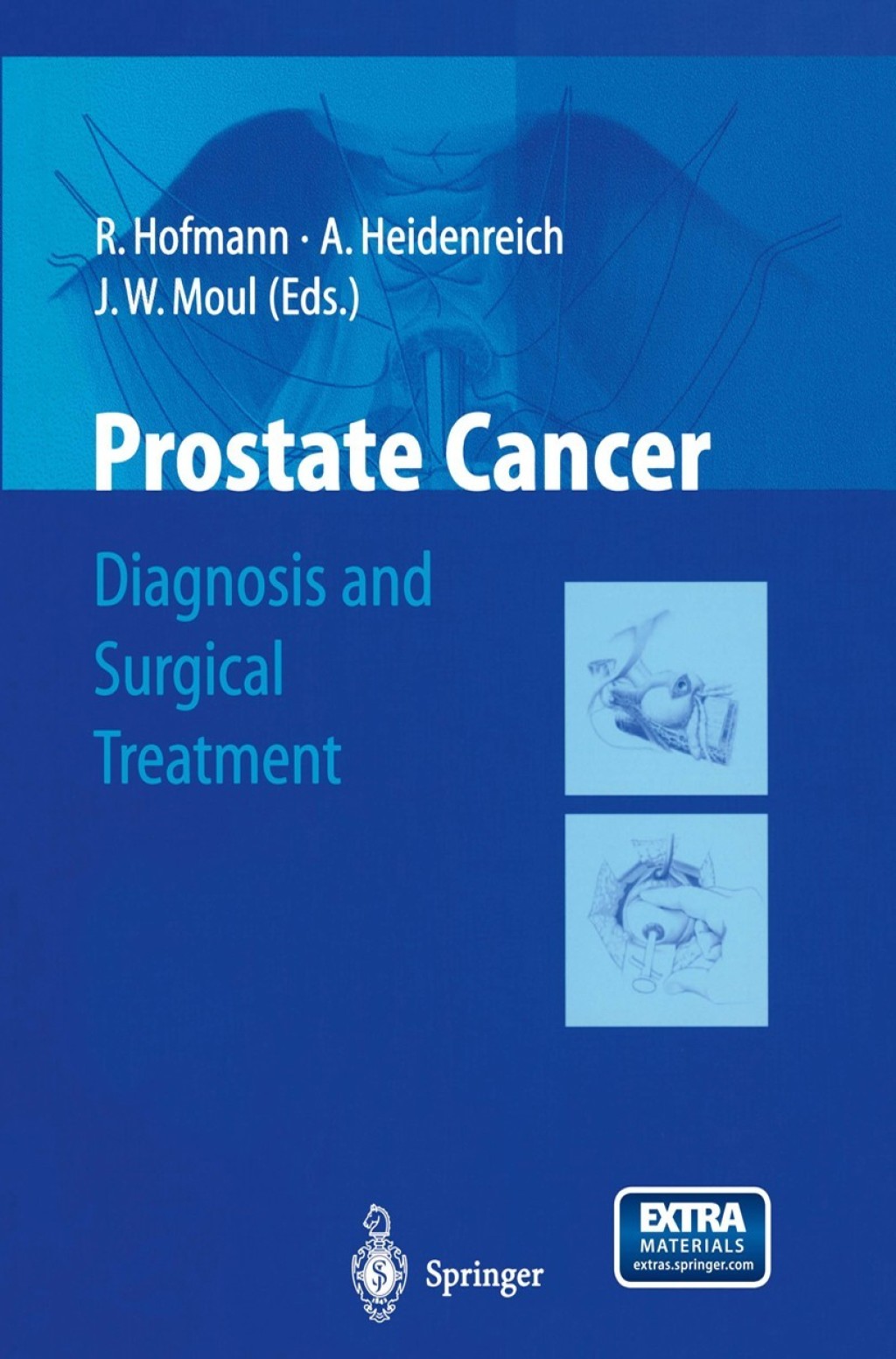 Prostate Cancer Diagnosis and Surgical Treatment 1st Edition