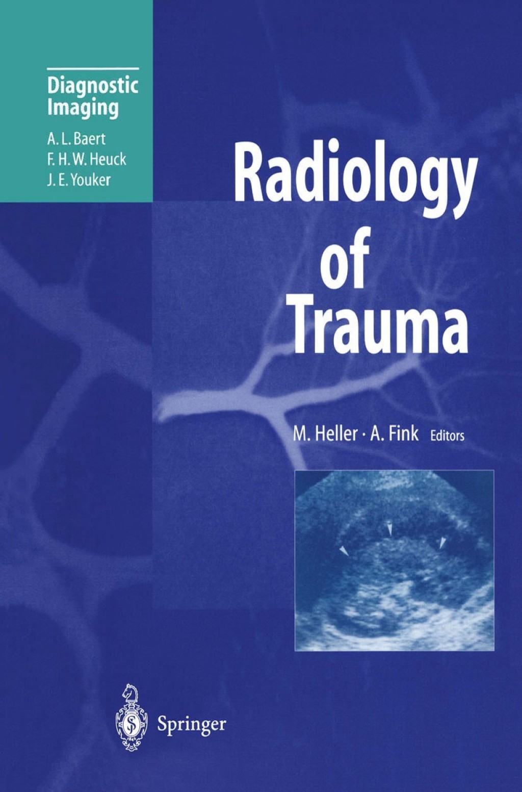 Radiology of Trauma 1st Edition