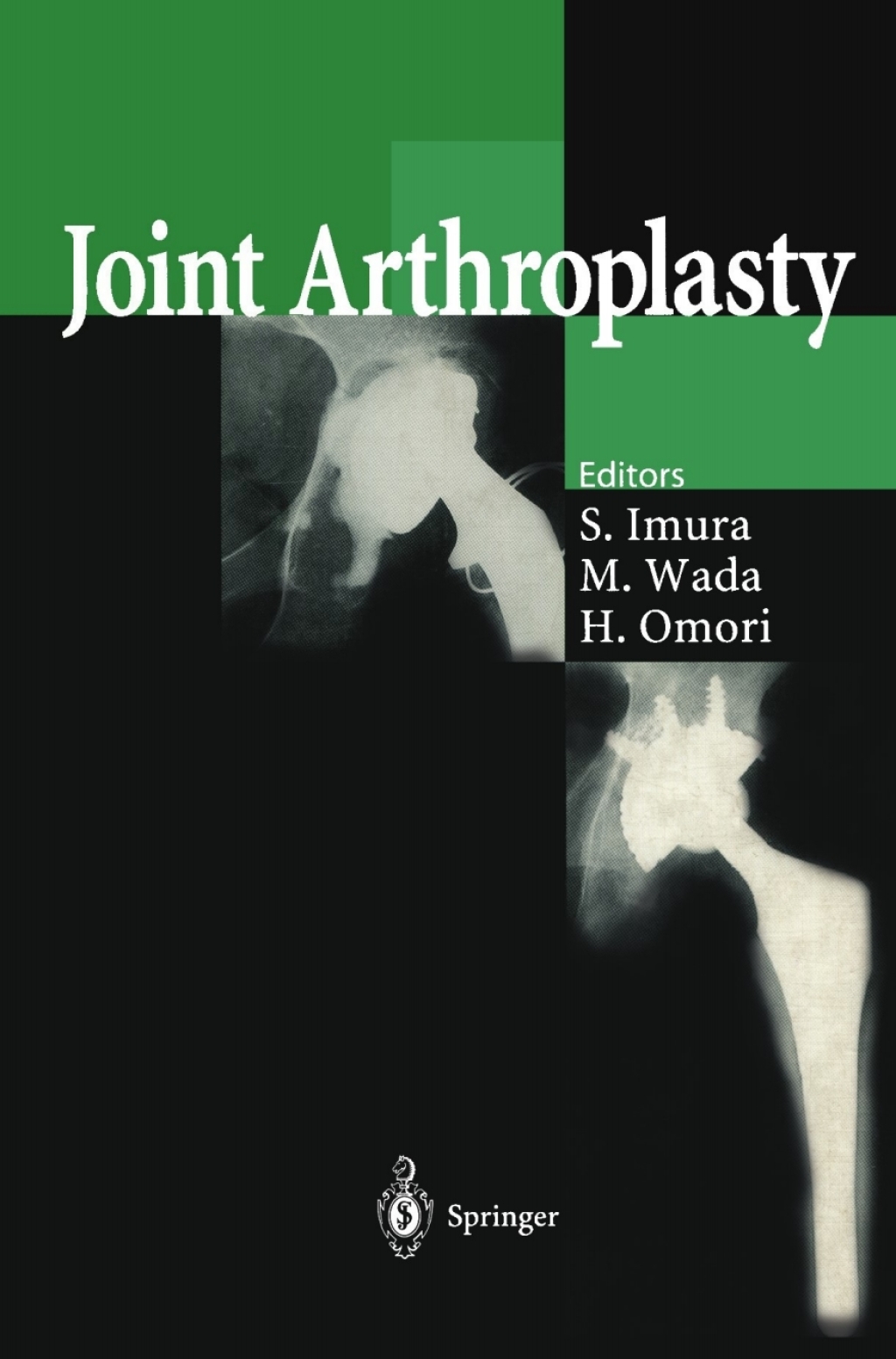 Joint Arthroplasty 1st Edition