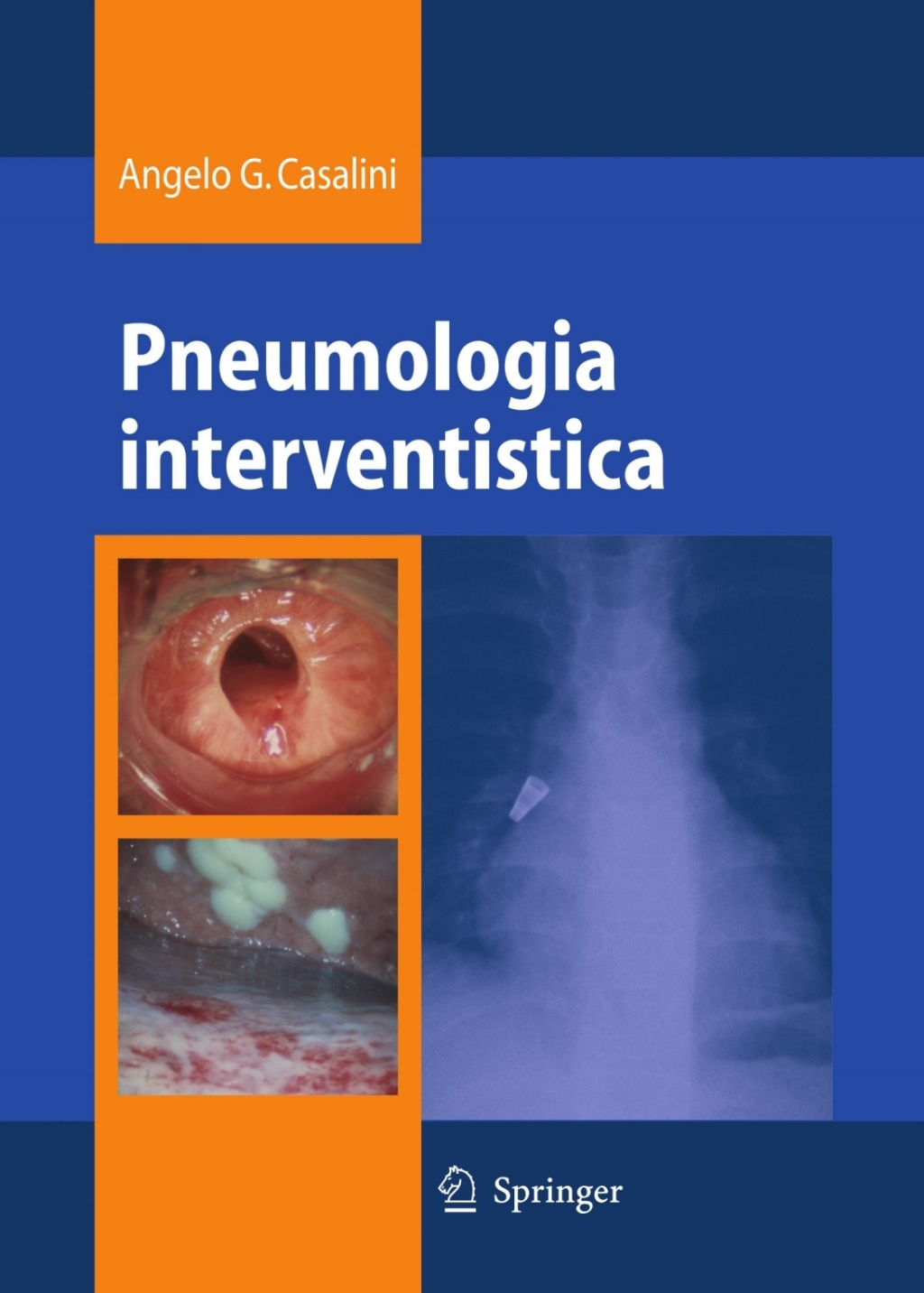 Pneumologia interventistica
