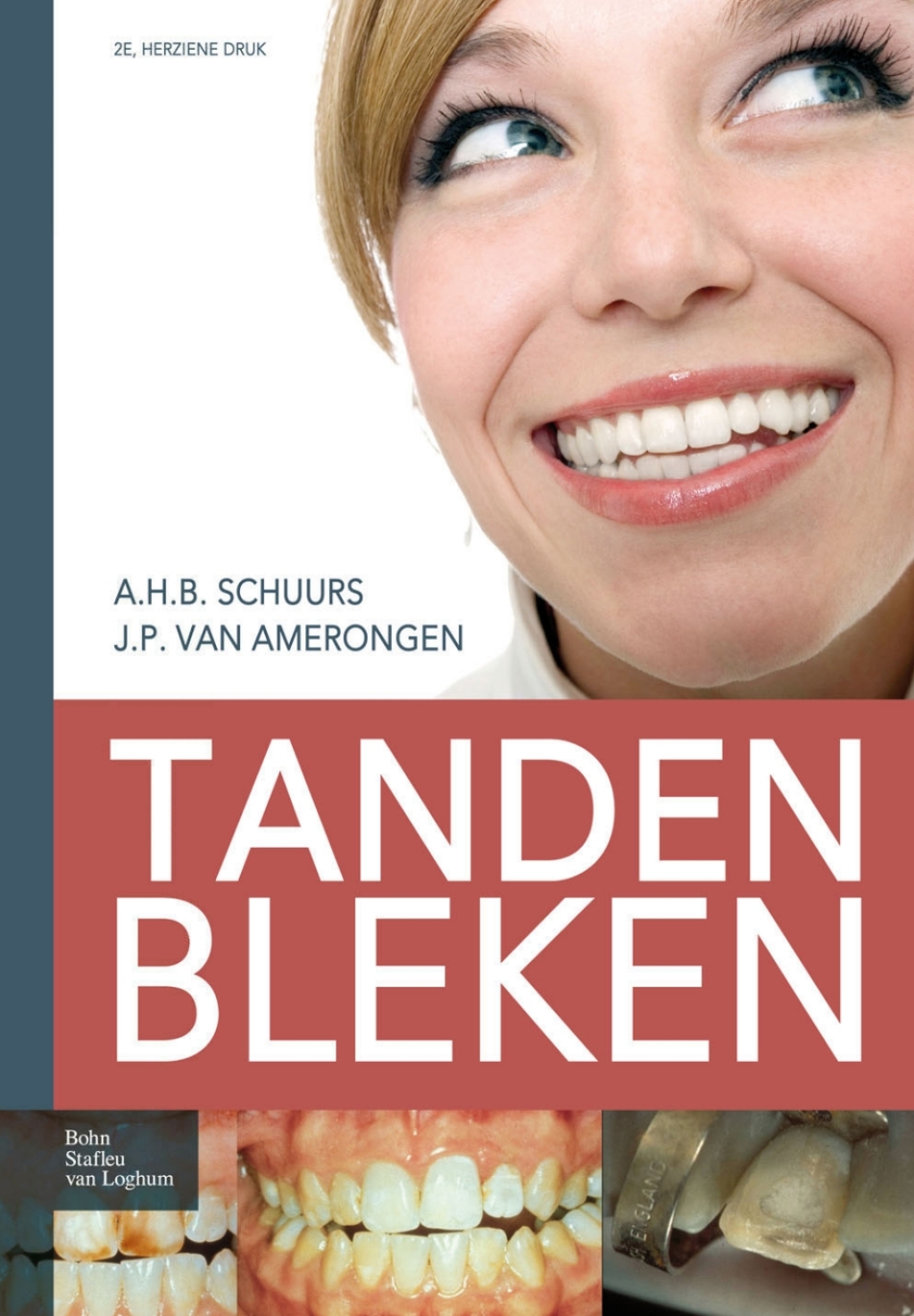 Tanden bleken 2nd Edition