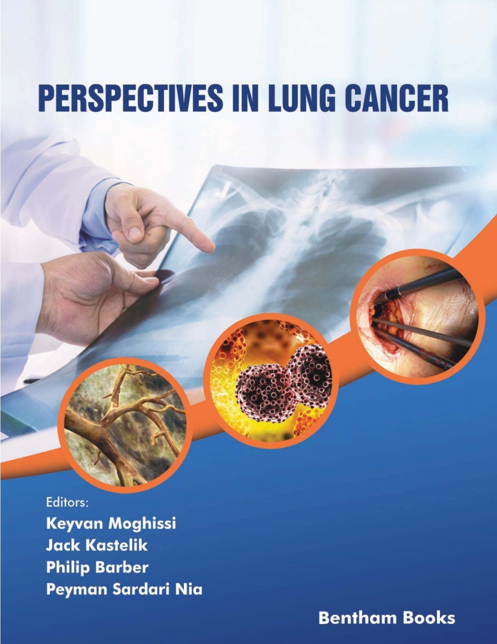 Perspectives in Lung Cancer 1st Edition